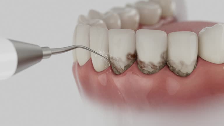 Trusted Teeth Cleaning And Checkup service in Porters Neck, NC - Dentist Open Now
